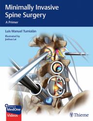 Minimally Invasive Spine Surgery : A Primer