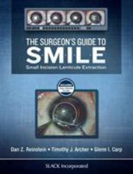 The Surgeon's Guide to SMILE : Small Incision Lenticule Extraction