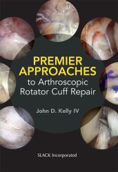 Premier Approaches to Arthroscopic Rotator Cuff Repair