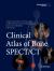 Clinical Atlas of Bone SPECT/CT