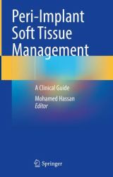 Peri-Implant Soft Tissue Management : A Clinical Guide