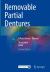 Removable Partial Dentures : A Practitioners' Manual