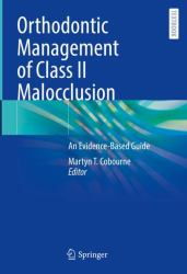 Orthodontic Management of Class II Malocclusion : An Evidence-Based Guide