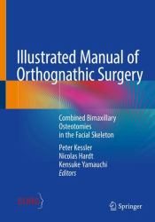 Illustrated Manual of Orthognathic Surgery : Combined Bimaxillary Osteotomies in the Facial Skeleton