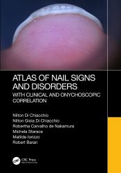 Atlas of Nail Signs and Disorders with Clinical and Onychoscopic Correlation