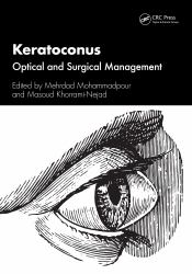 Keratoconus : Optical and Surgical Management