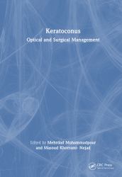 Keratoconus : Optical and Surgical Management