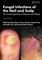 Fungal Infections of the Nail and Scalp : The Current Approach to Diagnosis and Therapy