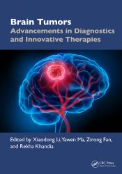 Brain Tumors : Advancements in Diagnostics and Innovative Therapies