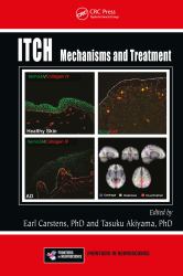 Itch : Mechanisms and Treatment