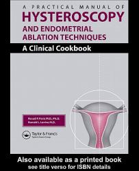 Practical Manual of Hysteroscopy and Endometrial Ablation Techniques