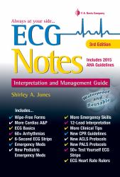 ECG Notes : Interpretation and Management Guide