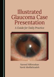 Illustrated Glaucoma Case Presentation : A Guide for Daily Practice