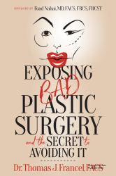 Exposing Bad Plastic Surgery : And the Secret to Avoiding It