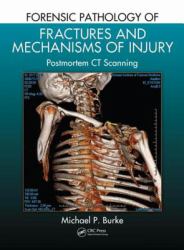 Forensic Pathology of Fractures and Mechanisms of Injury