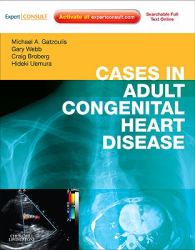 Cases in Adult Congenital Heart Disease - Expert Consult: Online and Print : Atlas