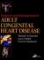 Diagnosis and Management of Adult Congenital Heart Disease