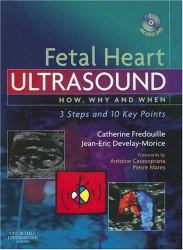 Fetal Heart Ultrasound