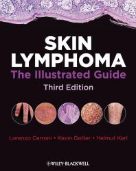 Skin Lymphoma : The Illustrated Guide