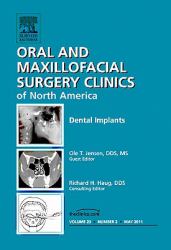 Dental Implants, an Issue of Oral and Maxillofacial Surgery Clinics