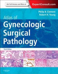 Atlas of Gynecologic Surgical Pathology : Expert Consult: Online and Print