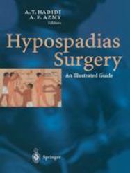 Hypospadias Surgery : An Illustrated Guide