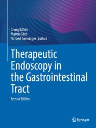 Therapeutic Endoscopy in the Gastrointestinal Tract