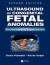 Ultrasound of Congenital Fetal Anomalies