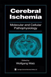 Cerebral Ischemia