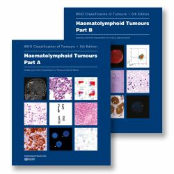 Haematolymphoid Tumours : WHO Classification of Tumours