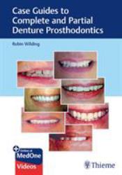 Case Guides to Complete and Partial Denture Prosthodontics