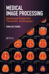 Medical Image Processing : Advanced Fuzzy Set Theoretic Techniques